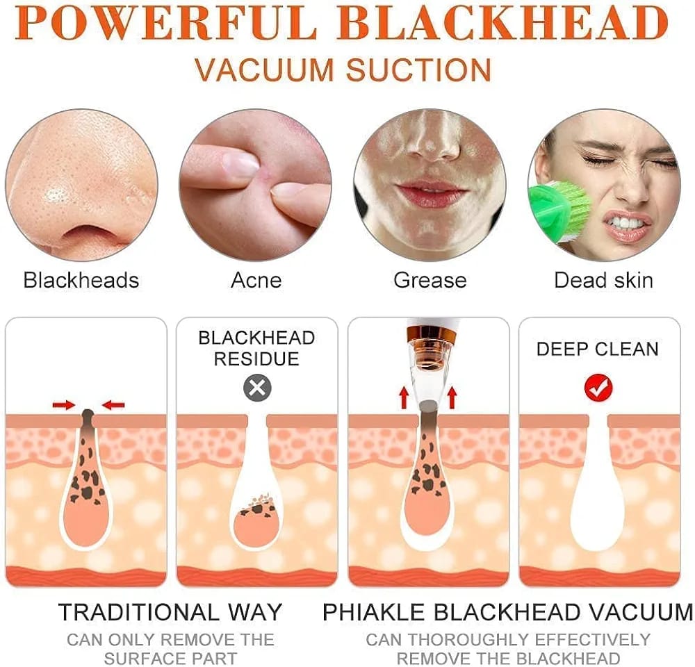 Blackhead Remover Vacuum – Deep Pore Cleaner with 3 Suction Levels & 7 Heads