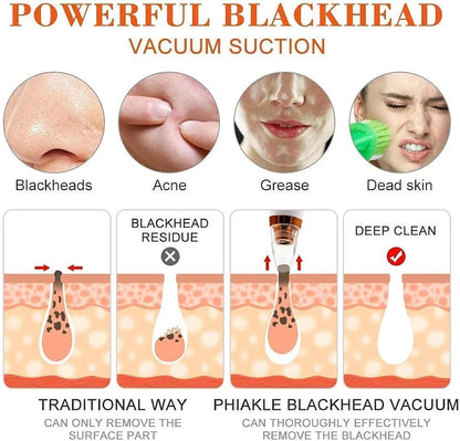Blackhead Remover Vacuum – Deep Pore Cleaner with 3 Suction Levels & 7 Heads